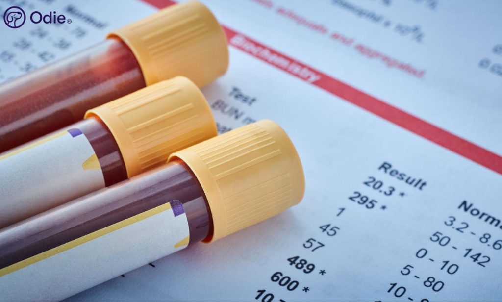 Blood collection vials resting on a printed veterinary biochemistry test result sheet.